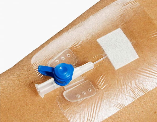 قیمت خرید چسب آنژیوکت با کیفیت بالا + شرایط فوق العاده 3